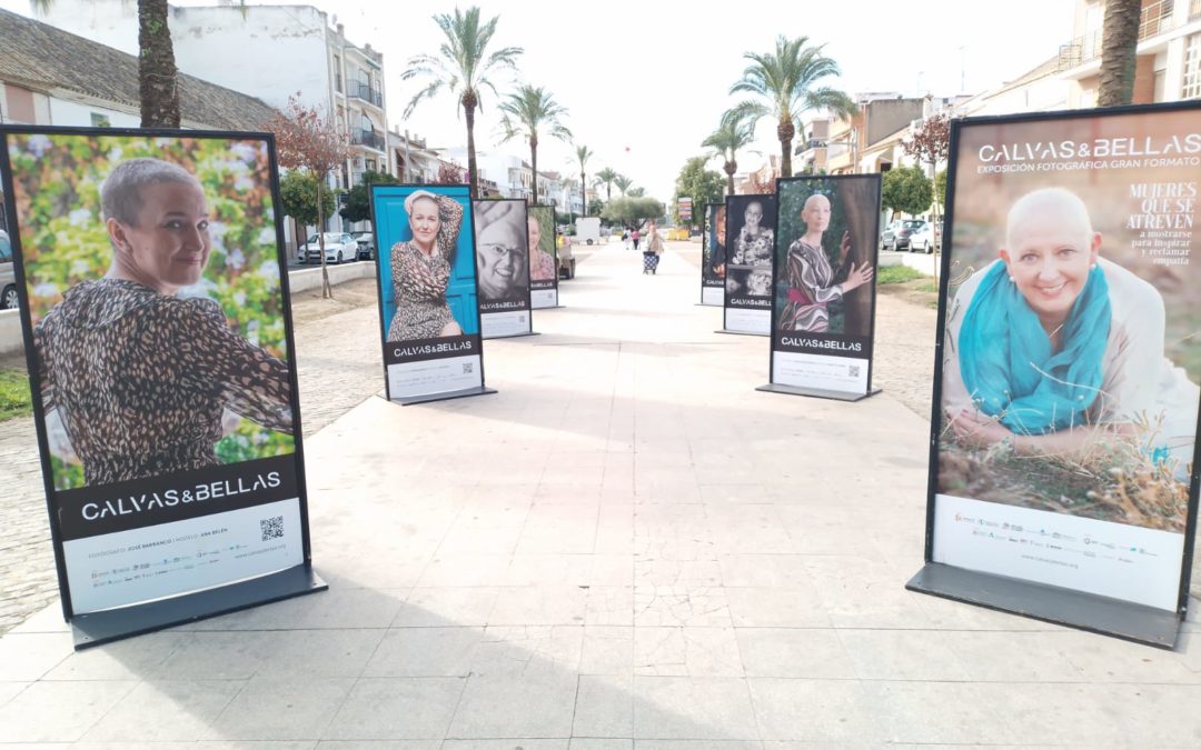 LA CARLOTA ACOGE LA EXPOSICIÓN FOTOGRÁFICA CALVAS&BELLAS, UBICADA EN EL BULEVAR DE LA AVENIDA DE CARLOS III, HASTA EL 12 DE DICIEMBRE